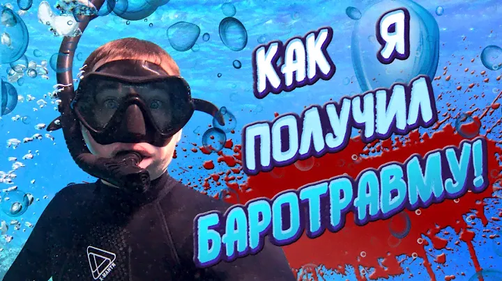 ЭТО БОЛЬНО | Получил баротравму в Египте | РИФ ОТЕЛЯ DOMINA CORAL BAY ШАРМ-ЭЛЬ-ШЕЙХ | Обзор пляжа