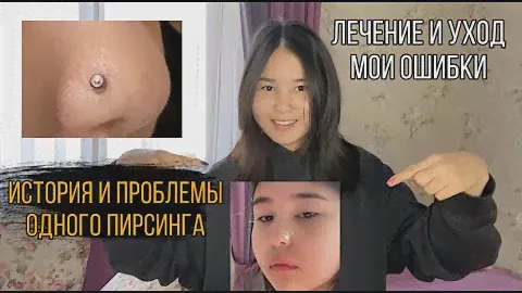 Мне УЖАСНО ПРОКОЛОЛИ НОС. Мой пирсинг. Прокол и Воспаление